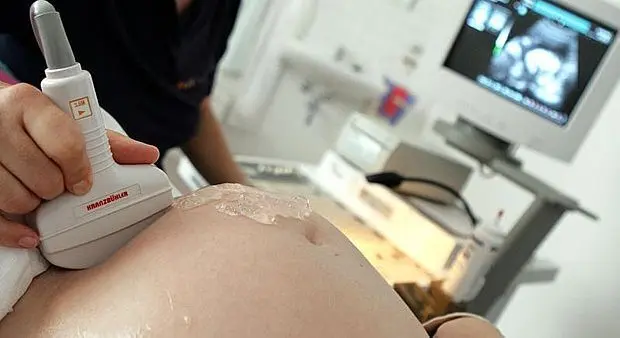 Los partos se pueden inducir a partir de la 38 semanas pero siempre bajo prescripci&oacute;n m&eacute;dica. -  