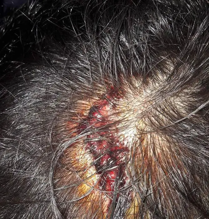 Imagen de las consecuencias de la agresi&oacute;n - Ereagafoto