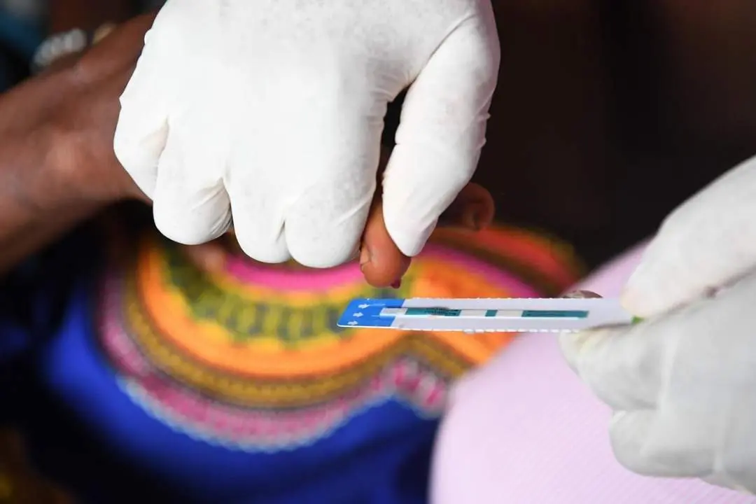 Prueba sangu&iacute;nea para detectar el virus del VIH. - unicef