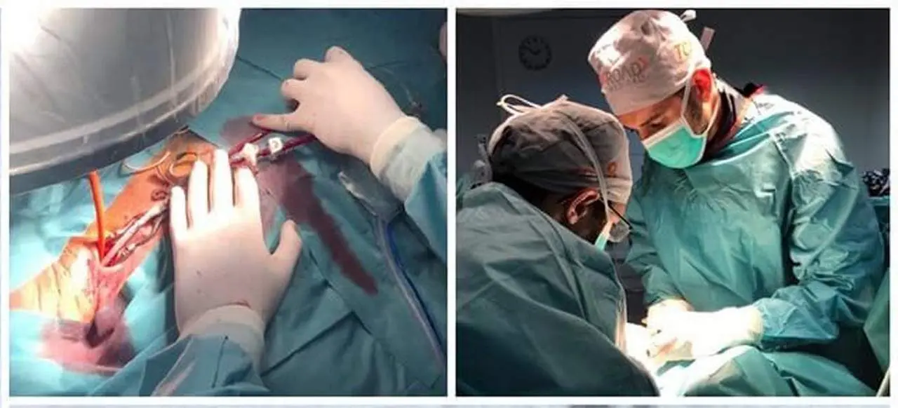 Dos m&eacute;dicos del centro hospitalario marbell&iacute; trabajan en este procedimiento. - Cedida