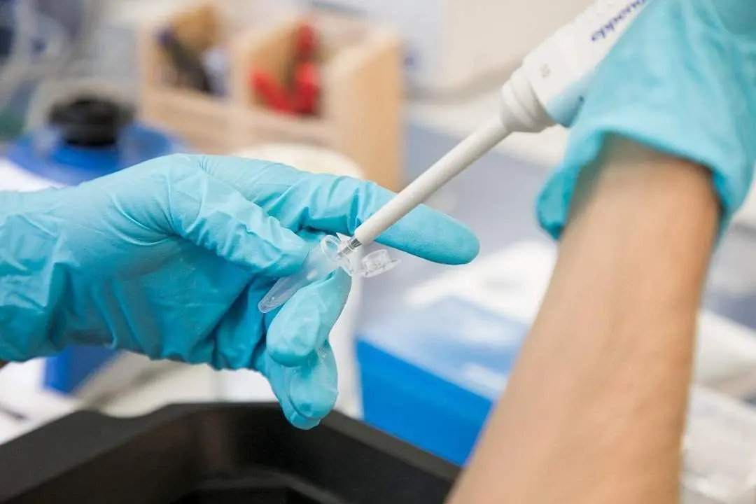 Muestras para una PCR. - EP