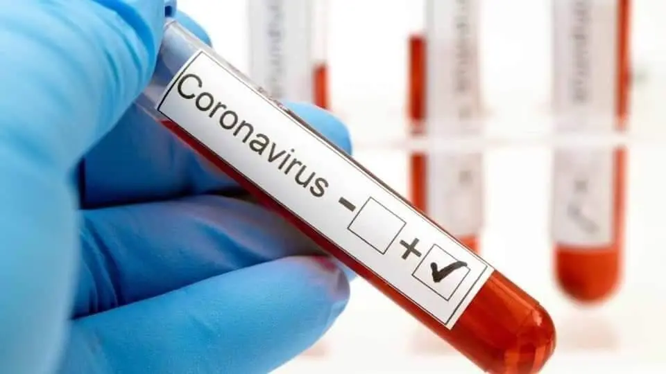 Test de coronavirus. - 