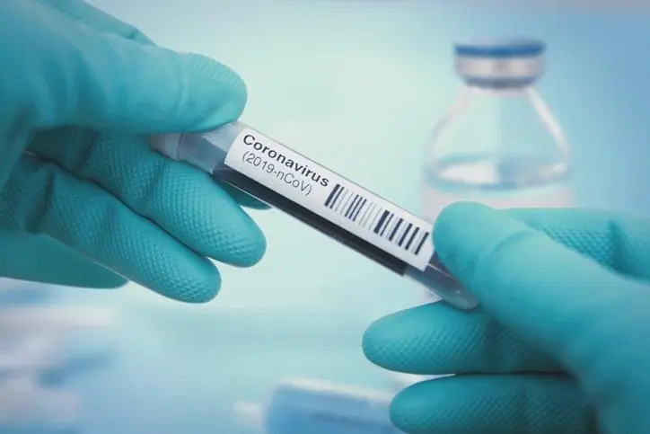 Test de Coronavirus. - EP