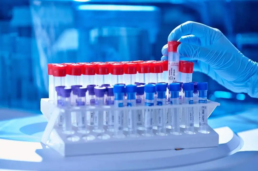 Test PCR. - Europa Press