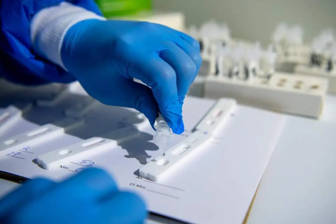 Test r&aacute;pido de coronavirus. - EP