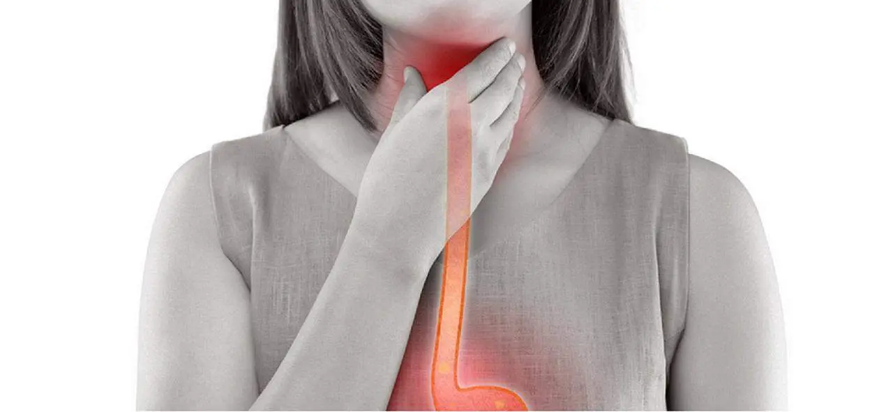 Dolor de garganta. - naturalherbsclinic/pixabay