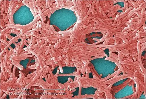 Legionella - E. P.