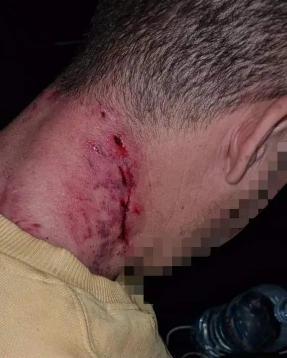 Vecino herido este mi&eacute;rcoles.  - Polic&iacute;a Local