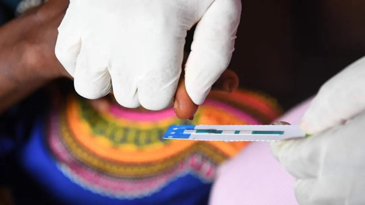 Prueba sangu&iacute;nea para detectar el virus del VIH. - unicef