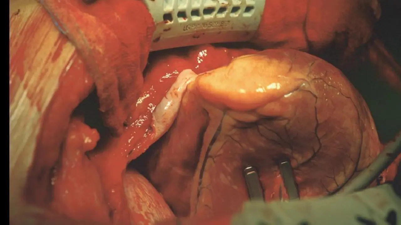 Las enfermedades cardiovasculares son un conjunto de trastornos del coraz&oacute;n y de los vasos sangu&iacute;neos. - 