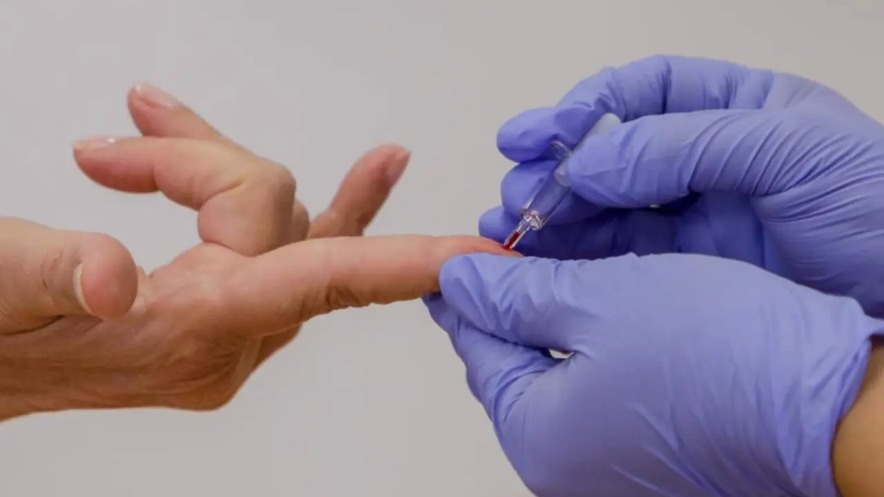 Test de coronavirus. - EP