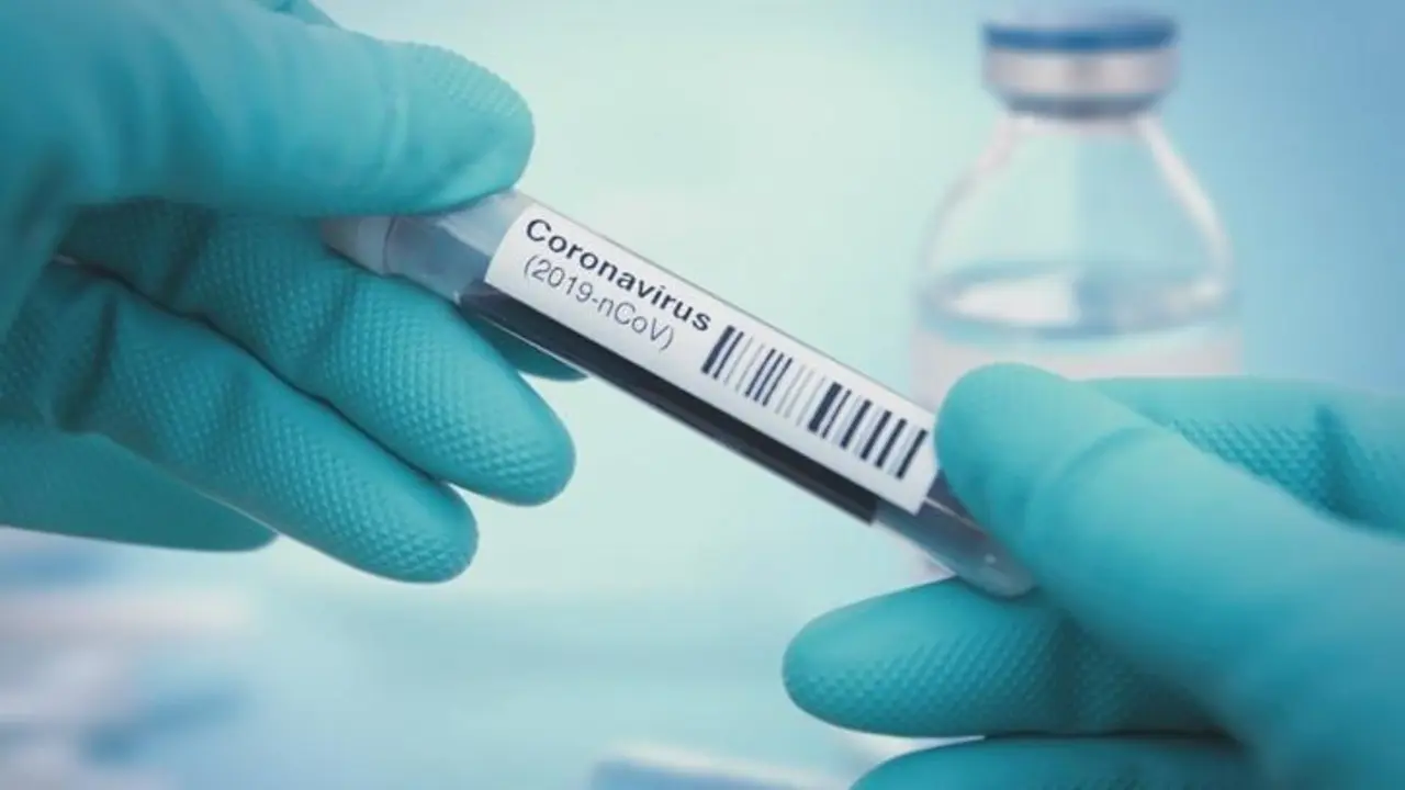 Test de Coronavirus. - EP