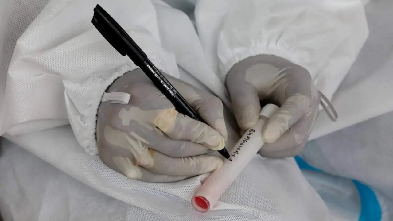 Pruebas de detecci&oacute;n del coronavirus. - Efe