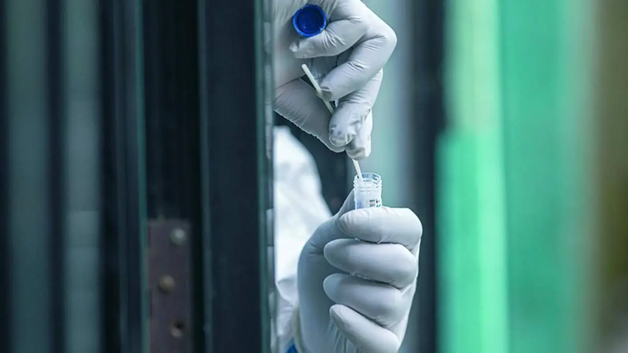 Test de coronavirus. - Junta