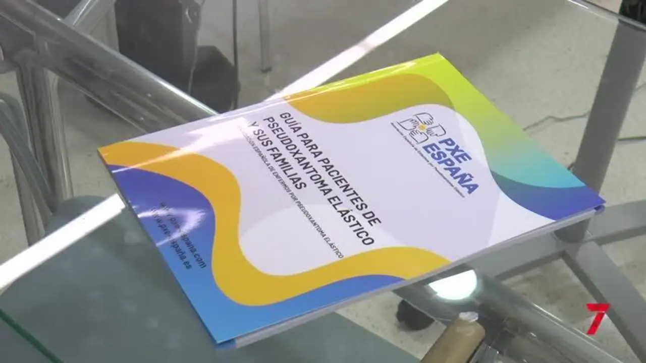 Enfermedad rara: Pacientes de toda Espa&ntilde;a viajan a M&aacute;laga para frenar al PXE