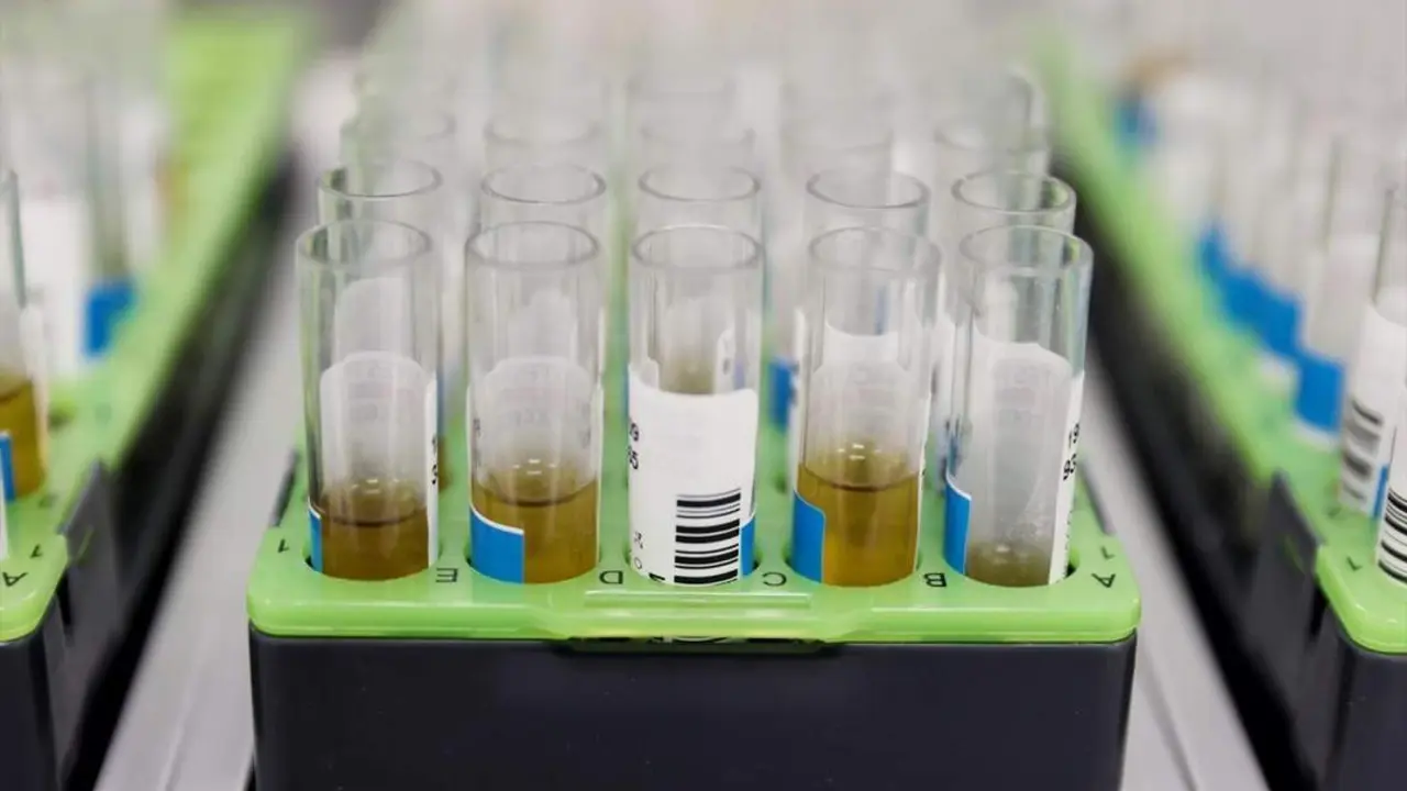 Probetas de pruebas PCR para la viruela del mono, foto de recurso. - Eduardo Parra - Europa Press