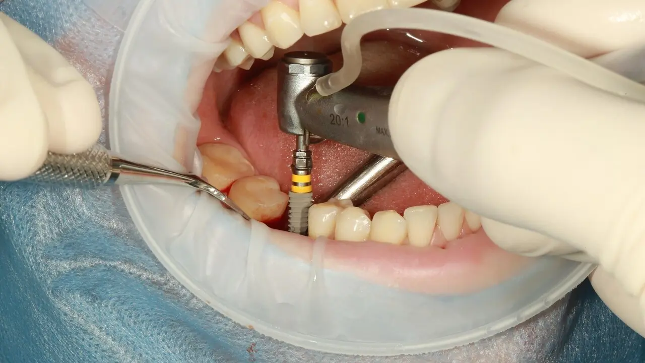Dentista,