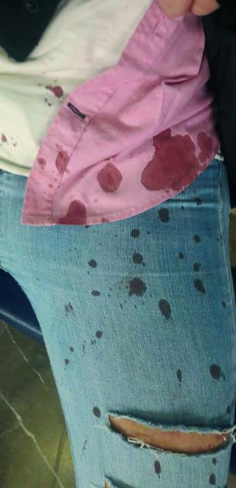 Imagen de las consecuencias de la agresiÃ³n